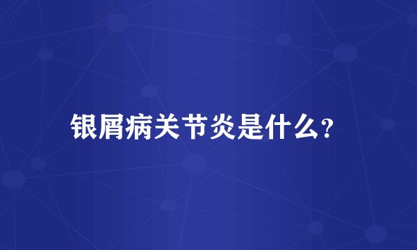 银屑病关节炎是什么？
