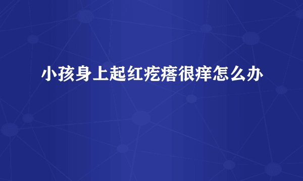 小孩身上起红疙瘩很痒怎么办