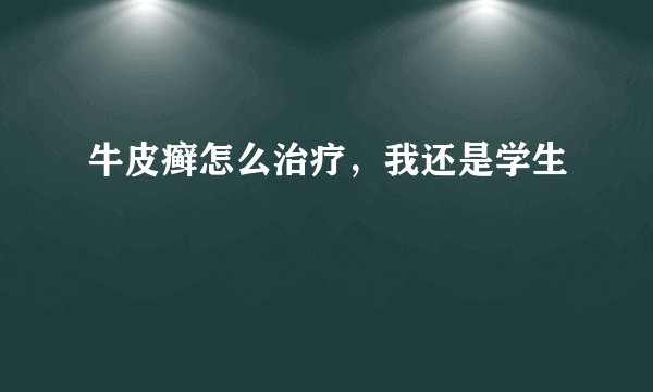 牛皮癣怎么治疗,我还是学生