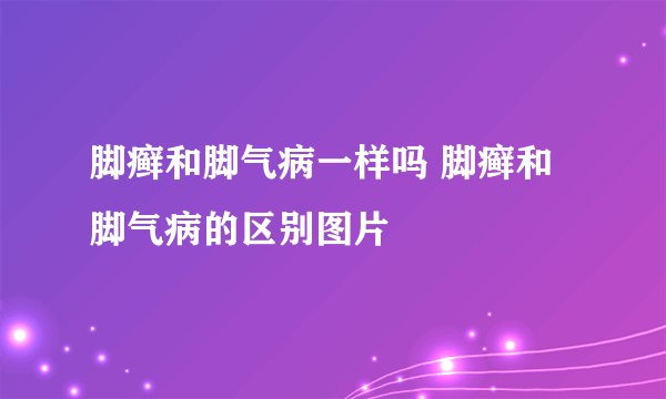 脚癣和脚气病一样吗 脚癣和脚气病的区别图片