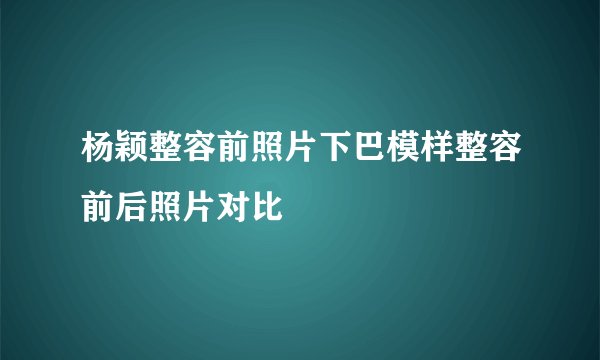 杨颖整容前照片下巴模样整容前后照片对比