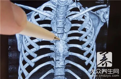 体检胸透主要检查什么呢?