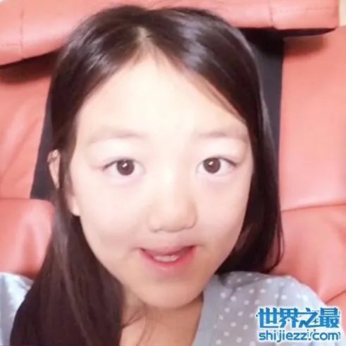 王菲李亚鹏女儿李嫣照片,天生唇腭裂却自信可爱