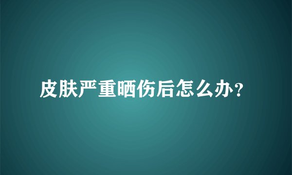 皮肤严重晒伤后怎么办？