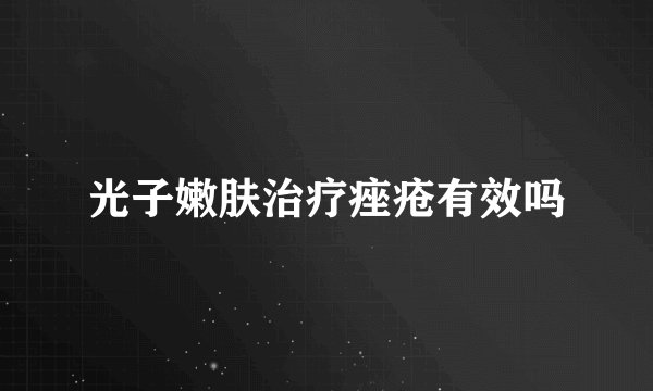 光子嫩肤治疗痤疮有效吗