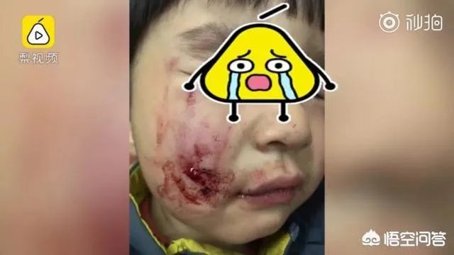 2岁娃等电梯时遭邻居3只狗迎面扑咬出血,事发8天后狗主人不露面不道歉,你怎么看?