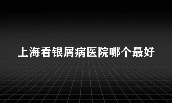 上海看银屑病医院哪个最好