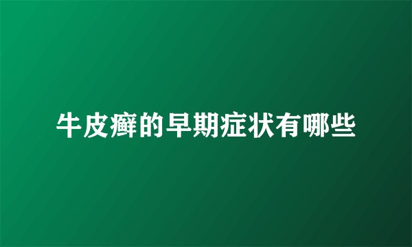 牛皮癣的早期症状有哪些