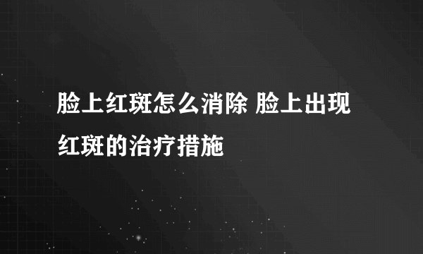 脸上红斑怎么消除 脸上出现红斑的治疗措施