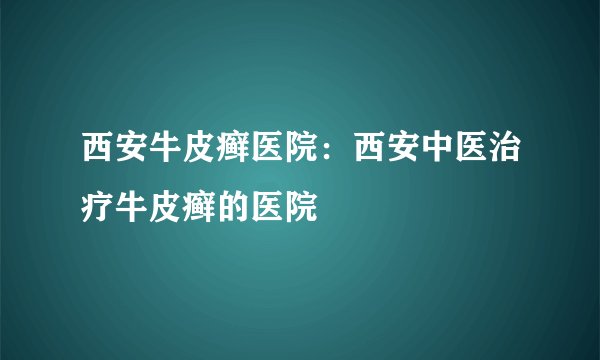 西安牛皮癣医院：西安中医治疗牛皮癣的医院