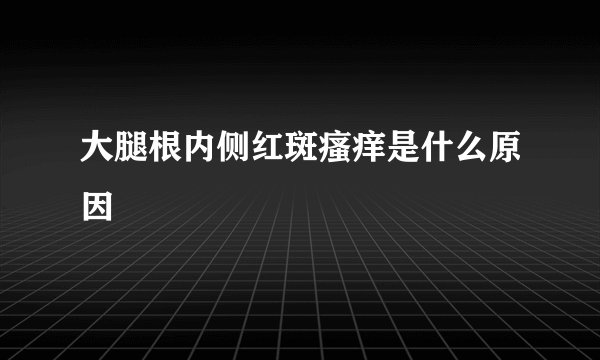 大腿根内侧红斑瘙痒是什么原因