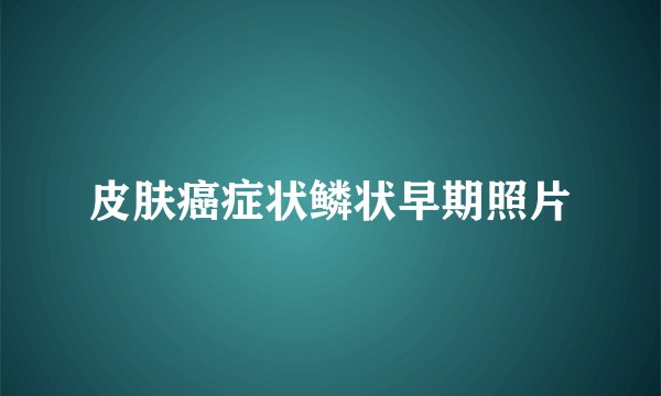 皮肤癌症状鳞状早期照片