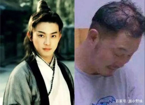 吴彦祖陷秃顶危机,黄晓明最意外, 5位遭遇“头发危机”的男明星都有谁?