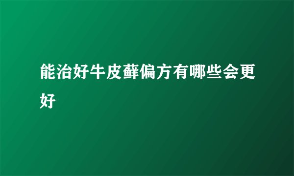 能治好牛皮藓偏方有哪些会更好