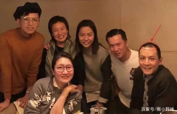吴彦祖陷秃顶危机,黄晓明最意外, 5位遭遇“头发危机”的男明星都有谁?