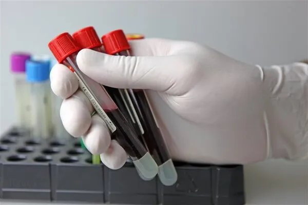 宋慧乔曾计划备孕，高龄备孕一定要做这些检查