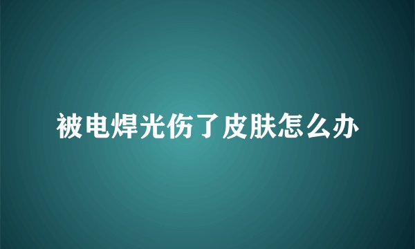 被电焊光伤了皮肤怎么办