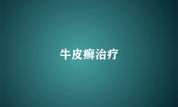 牛皮癣治疗