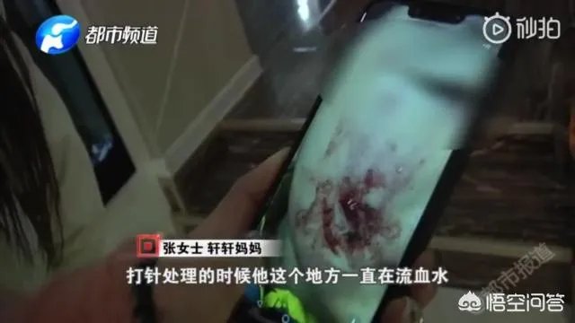 2岁娃等电梯时遭邻居3只狗迎面扑咬出血,事发8天后狗主人不露面不道歉,你怎么看?