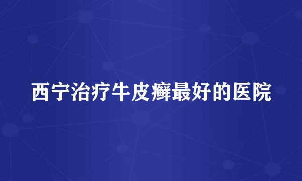 西宁治疗牛皮癣最好的医院