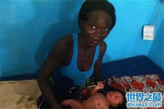 世界上最黑的孩子,一起来看一下最黑的孩子的出生和现状! ...
