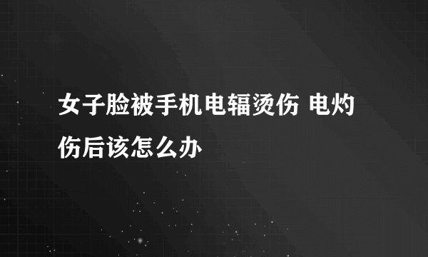女子脸被手机电辐烫伤 电灼伤后该怎么办