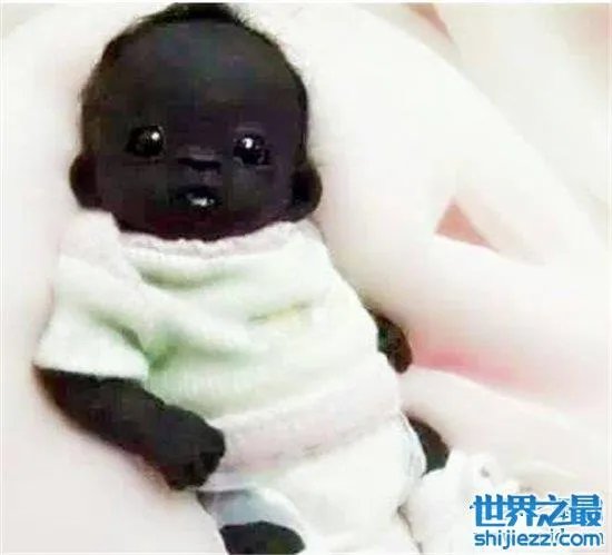 世界上最黑的孩子,一起来看一下最黑的孩子的出生和现状! ...