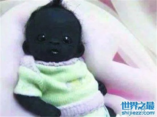 世界上最黑的孩子,一起来看一下最黑的孩子的出生和现状! ...