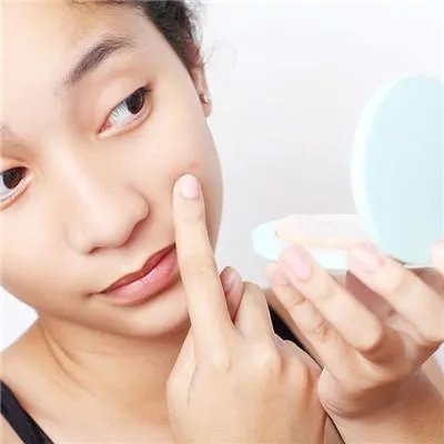 怎么除青春痘的治疗方法