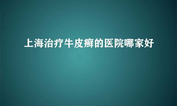 上海治疗牛皮癣的医院哪家好