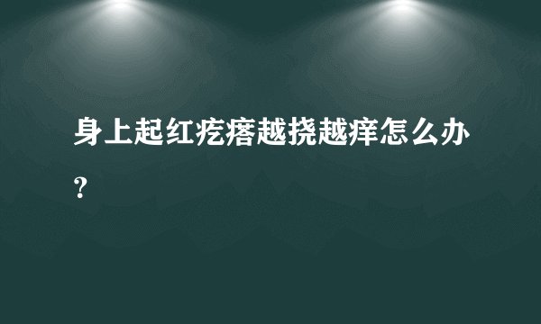 身上起红疙瘩越挠越痒怎么办？