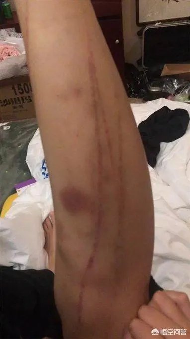 昔日的“洪荒少女”傅园慧现在做什么?还在做游泳运动员吗?