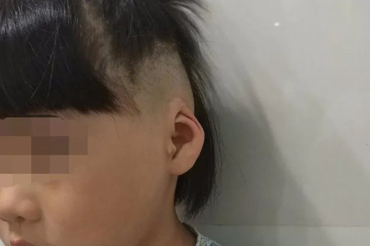 耳朵形状图