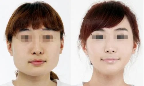 怎么瘦小脸
