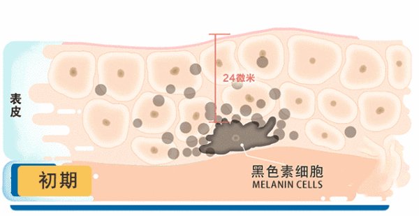 澜羽祛斑全新升级傲美蒂尔纯中药膜粉,真的能去痘吗?