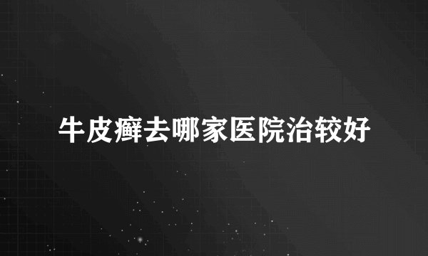 牛皮癣去哪家医院治较好