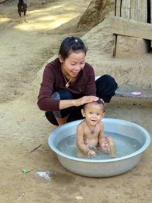 宝宝前额突出怎么办 宝宝前额突出原因