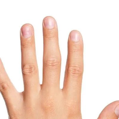 手足口病如何预防?