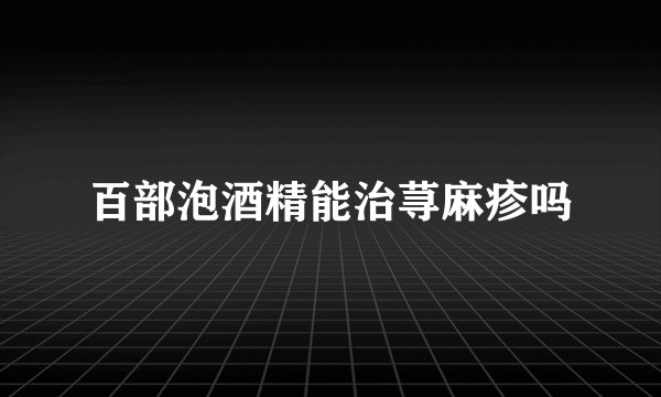 百部泡酒精能治荨麻疹吗