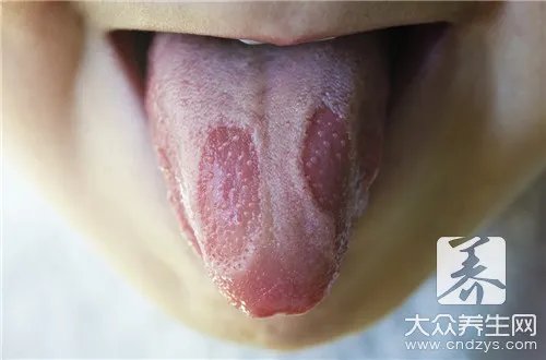 地图舌治疗最快方法