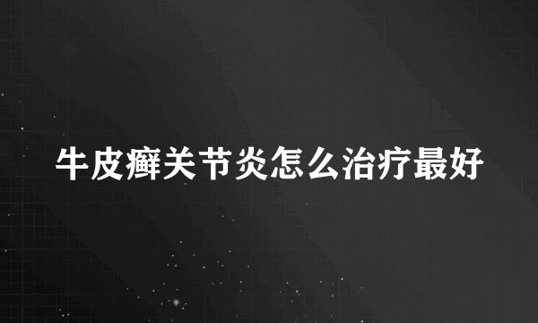 牛皮癣关节炎怎么治疗最好